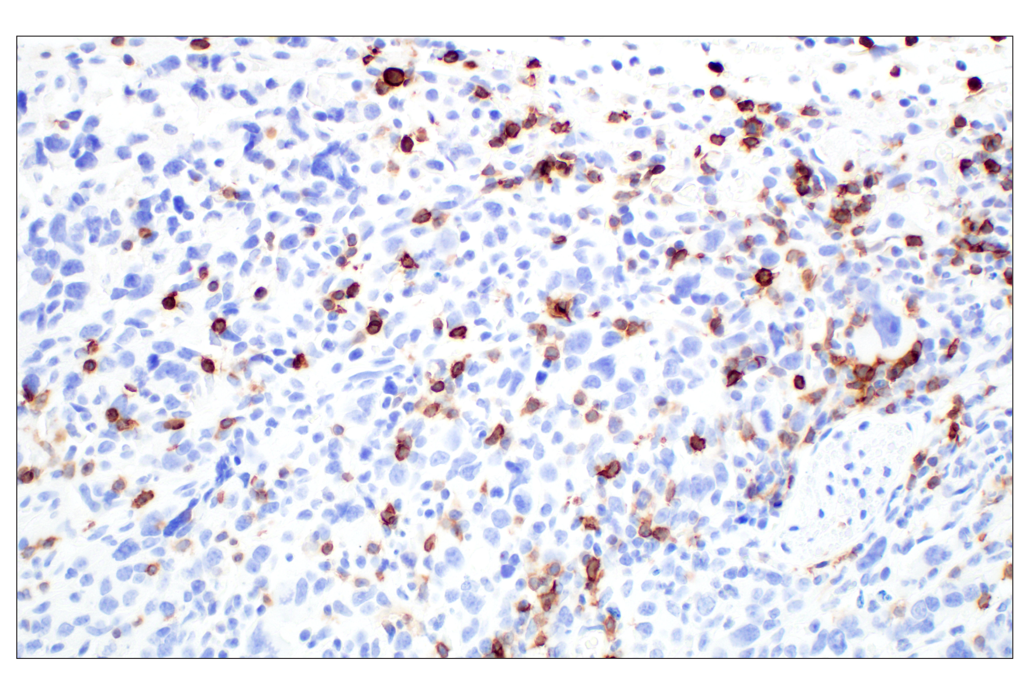 Immunohistochemistry Image 1: CD6 (E9Q1V) Rabbit mAb