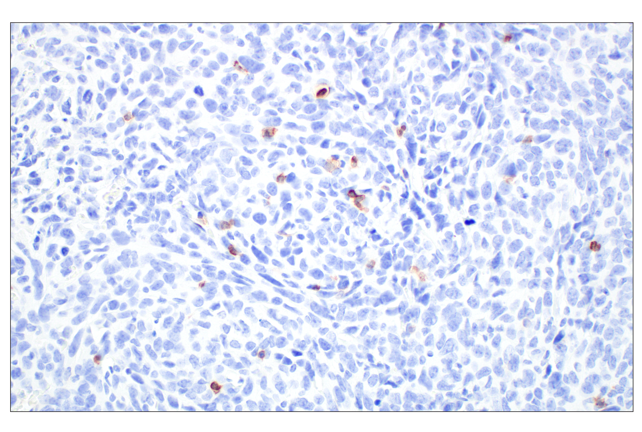 Immunohistochemistry Image 2: CD6 (E9Q1V) Rabbit mAb