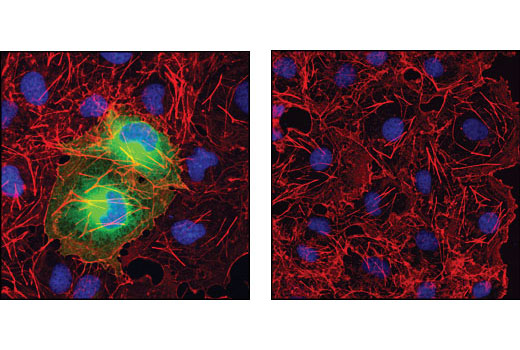 Immunofluorescence Image 1: HA-Tag (C29F4) Rabbit mAb (BSA and Azide Free)