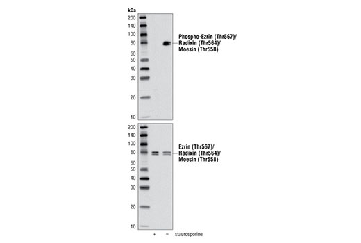  Image 15: Microglia LPS-Related Module Antibody Sampler Kit
