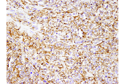  Image 24: Microglia LPS-Related Module Antibody Sampler Kit