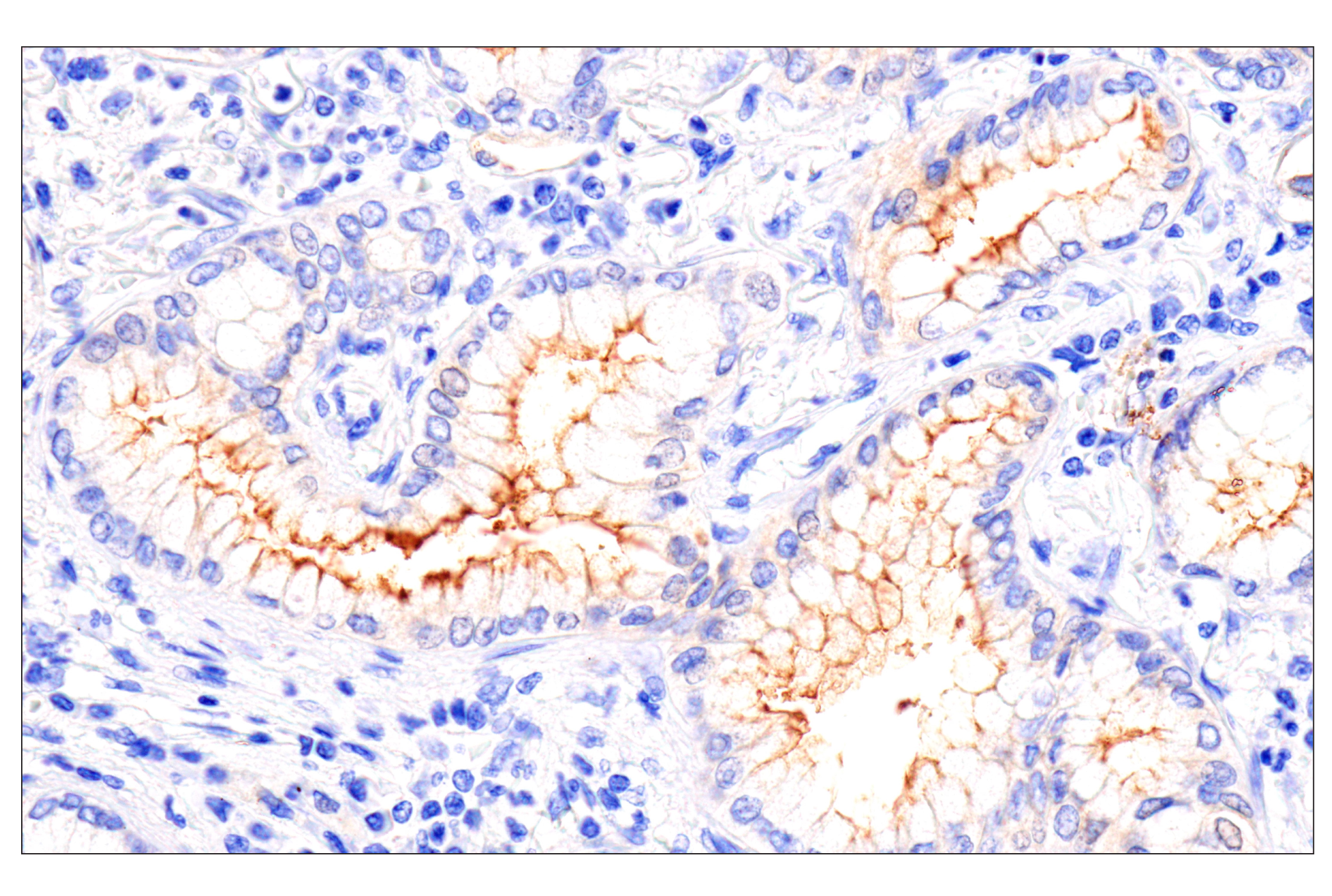 Immunohistochemistry Image 3: Folate Receptor Alpha/FOLR1 (BN3.2) Mouse mAb