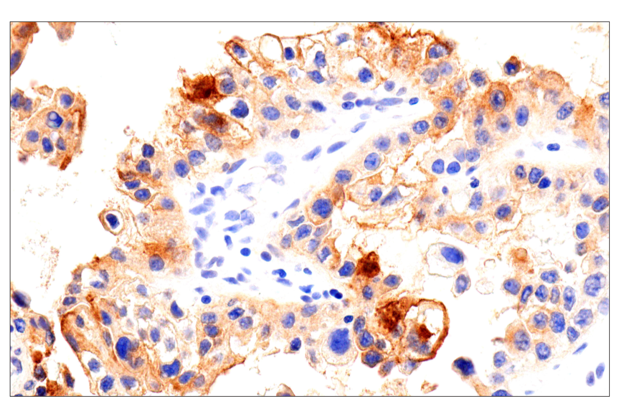 Immunohistochemistry Image 5: Folate Receptor Alpha/FOLR1 (BN3.2) Mouse mAb