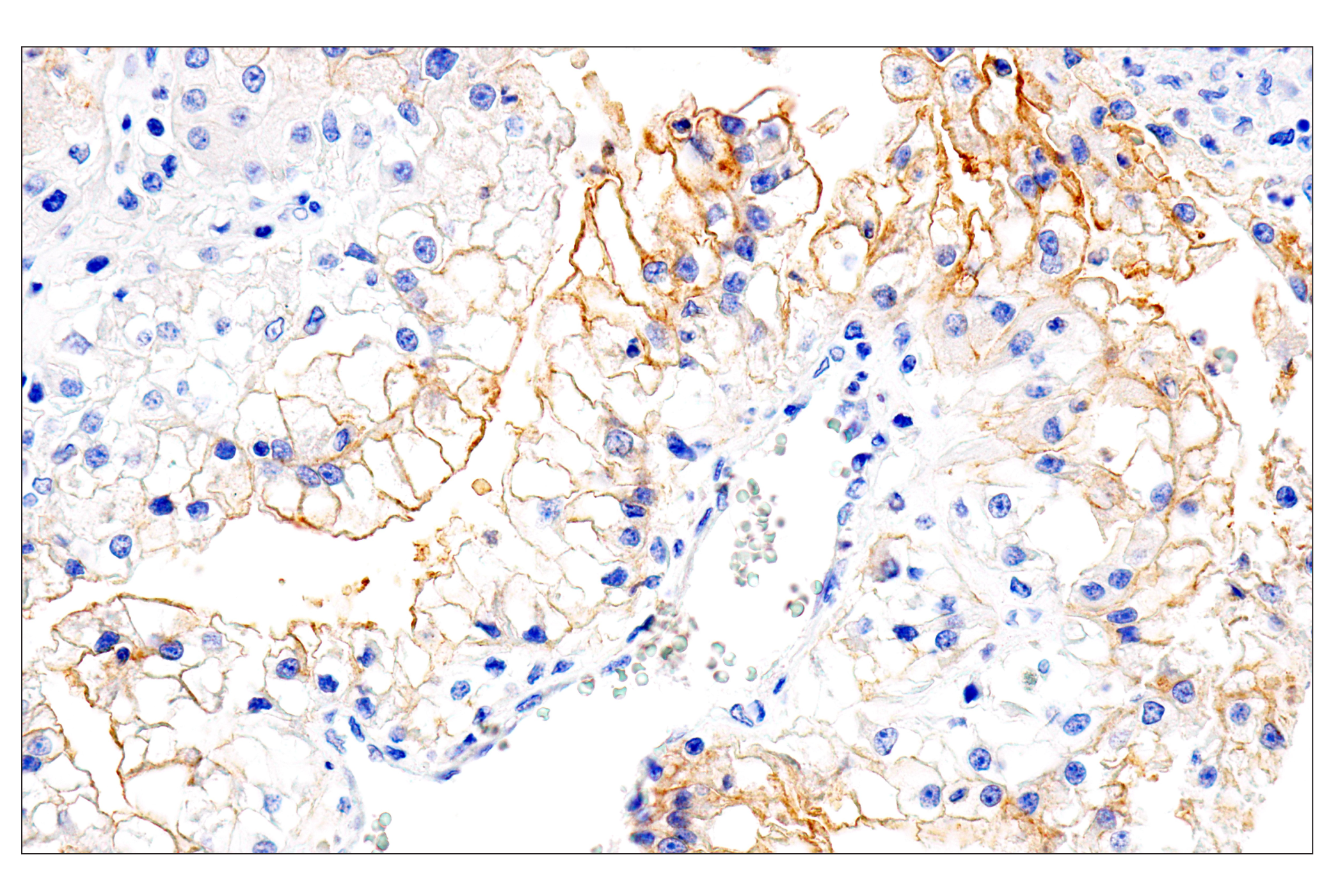 Immunohistochemistry Image 4: Folate Receptor Alpha/FOLR1 (BN3.2) Mouse mAb