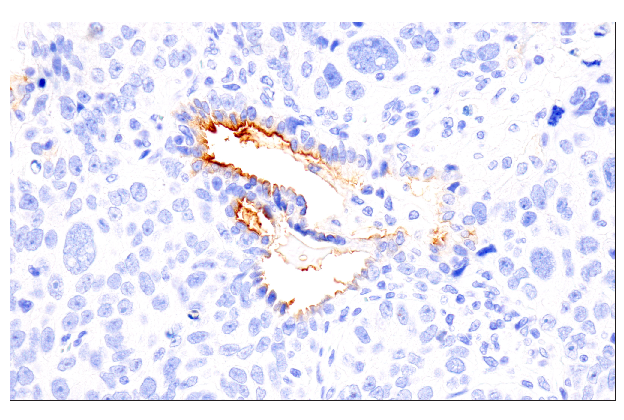 Immunohistochemistry Image 7: Folate Receptor Alpha/FOLR1 (BN3.2) Mouse mAb