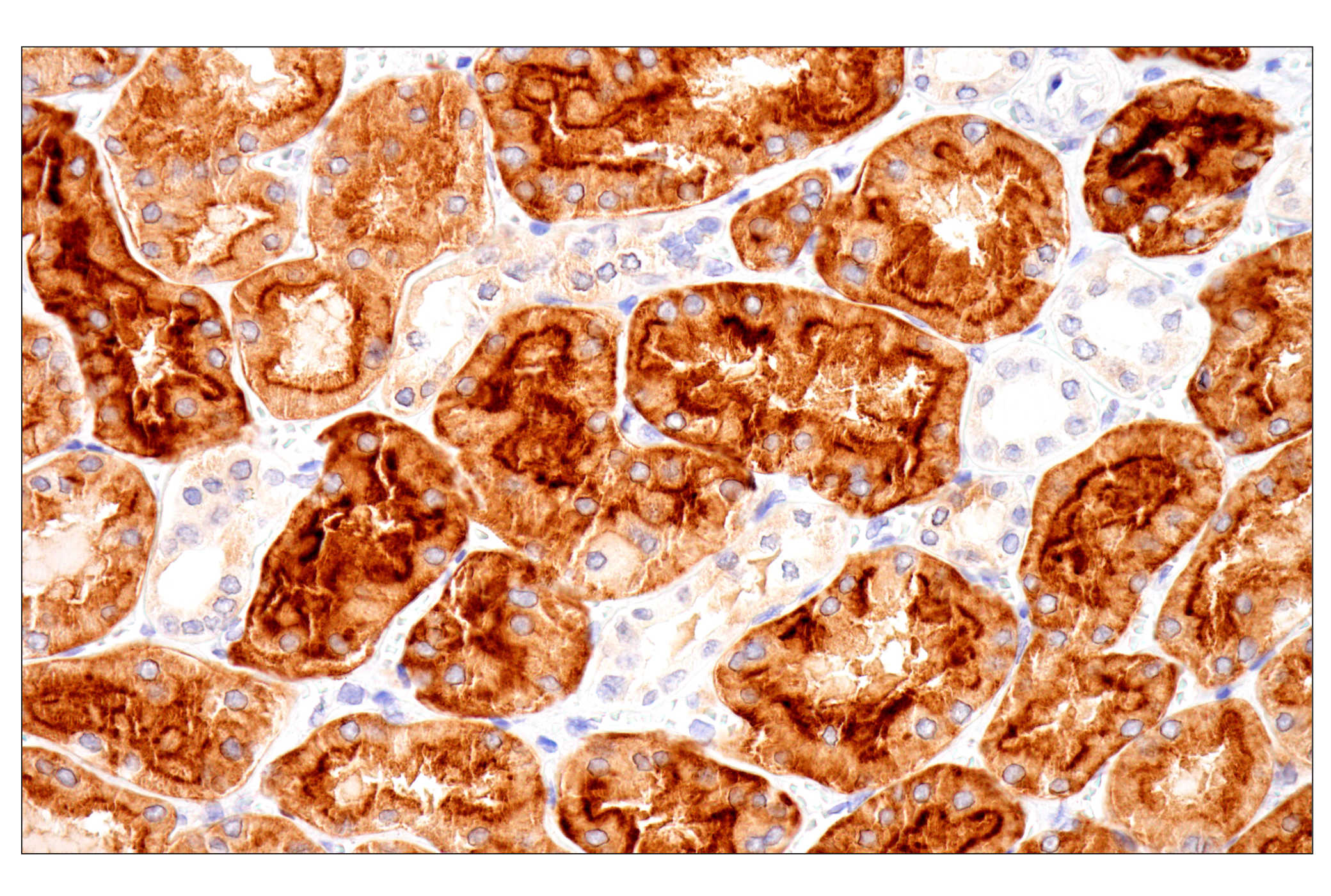 Immunohistochemistry Image 11: Folate Receptor Alpha/FOLR1 (BN3.2) Mouse mAb