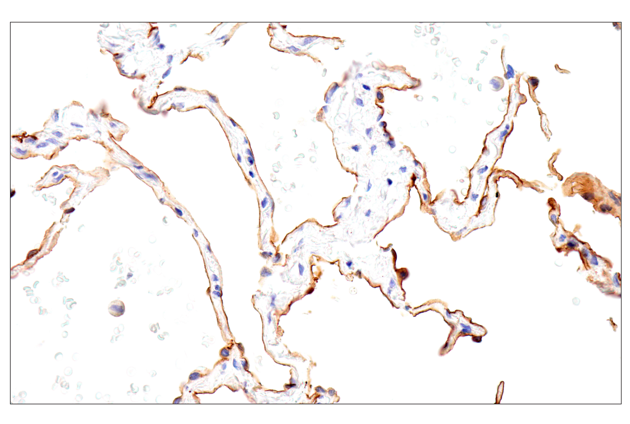 Immunohistochemistry Image 12: Folate Receptor Alpha/FOLR1 (BN3.2) Mouse mAb