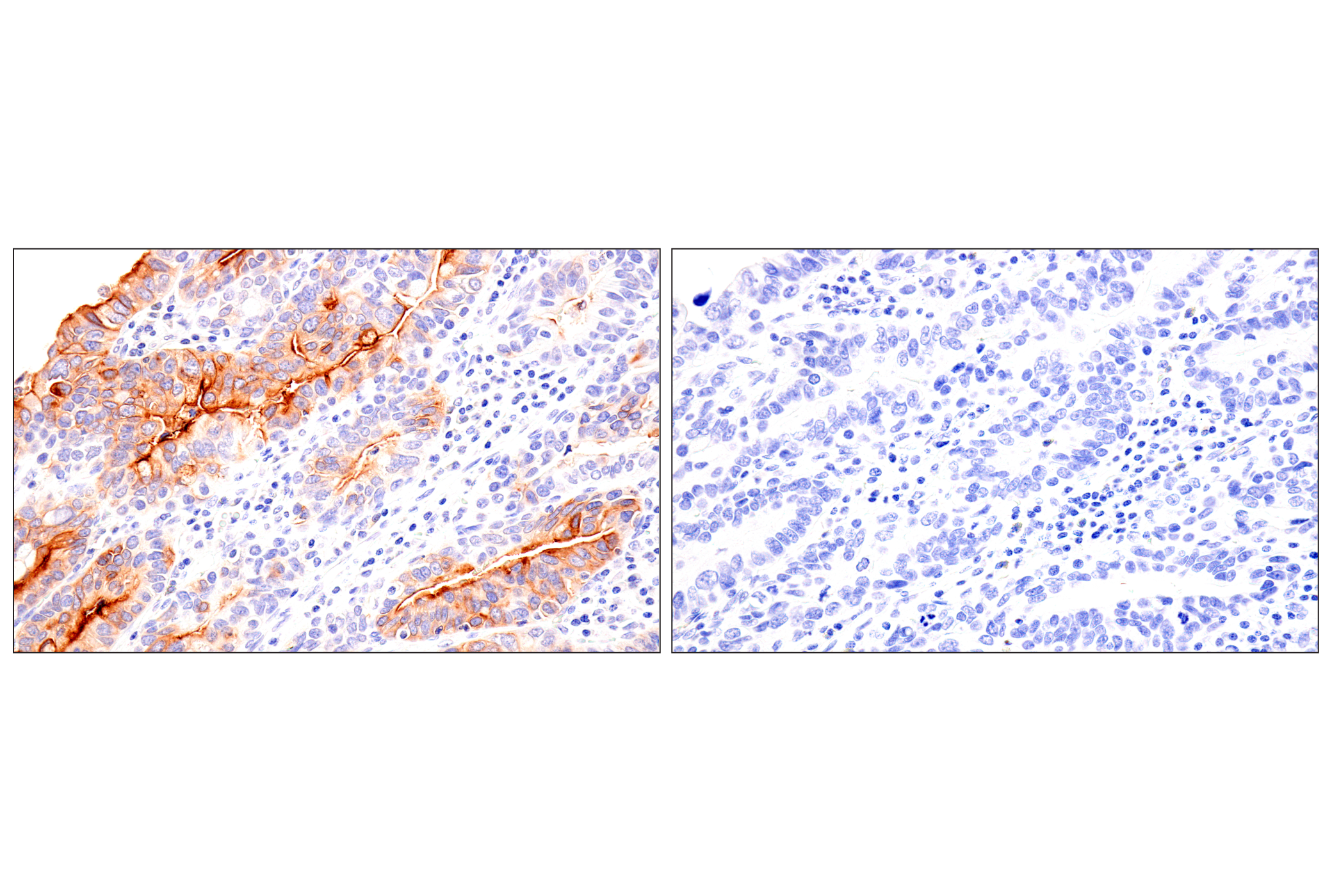 Immunohistochemistry Image 14: Folate Receptor Alpha/FOLR1 (BN3.2) Mouse mAb