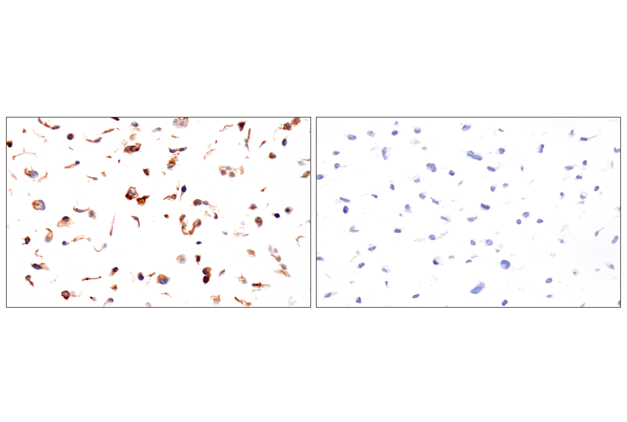 Immunohistochemistry Image 15: Folate Receptor Alpha/FOLR1 (BN3.2) Mouse mAb