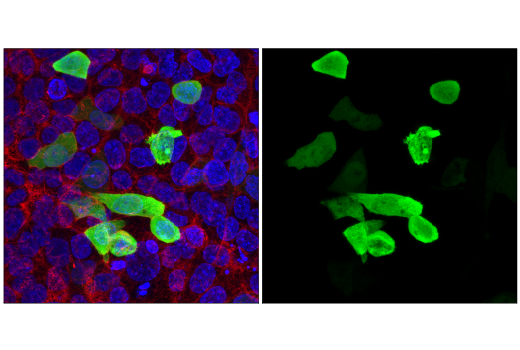 Immunofluorescence Image 1: HA-Tag (C29F4) Rabbit mAb (Alexa Fluor® 647 Conjugate)
