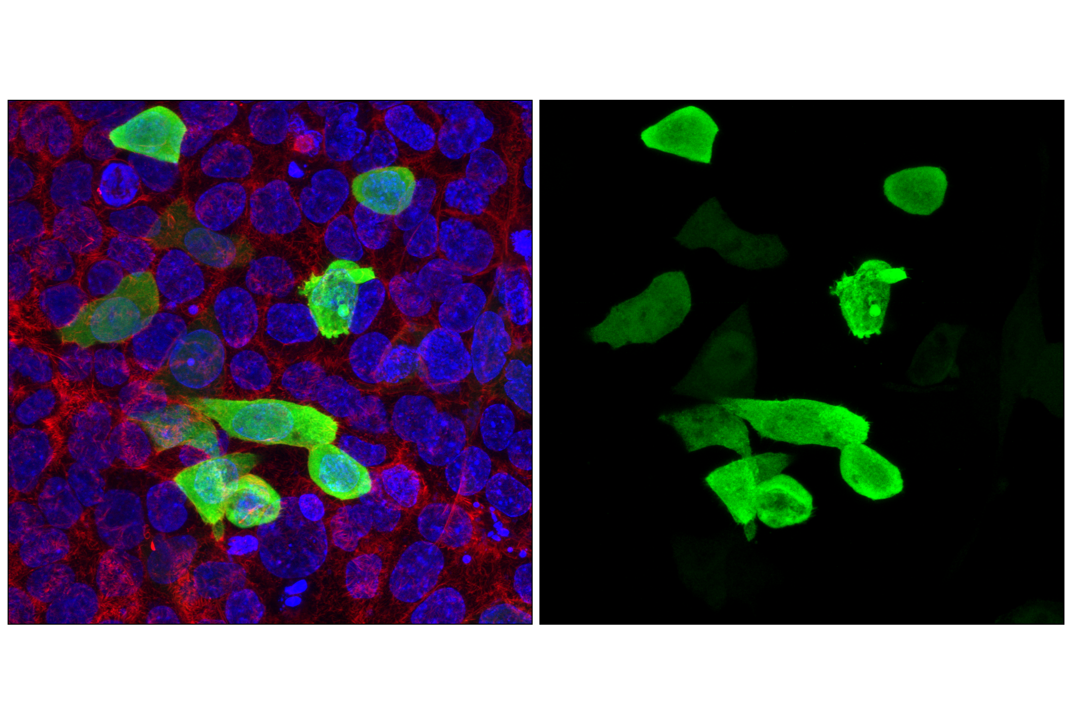 Immunofluorescence Image 1: HA-Tag (C29F4) Rabbit mAb (Alexa Fluor® 647 Conjugate)