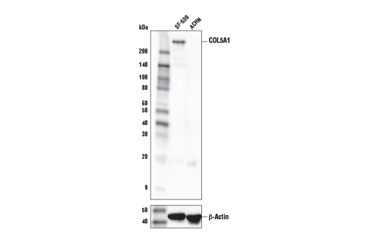 Western Blotting Image 1: COL5A1 Antibody