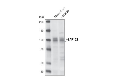 Western Blotting Image 1: SAP102 Antibody