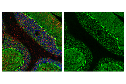 Immunofluorescence Image 1: GAT1 (E7J1B) Rabbit mAb