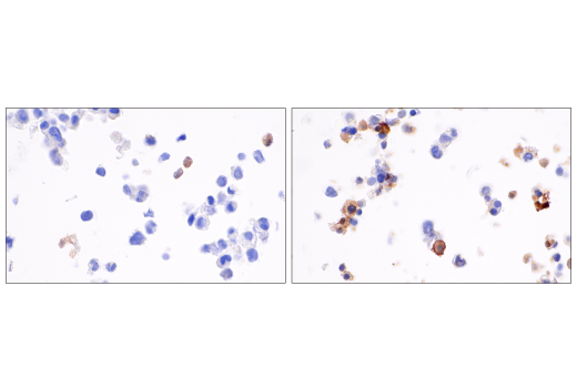 Immunohistochemistry Image 7: Cleaved Gasdermin D (Asp275) (E7H9G) Rabbit mAb (BSA and Azide Free)