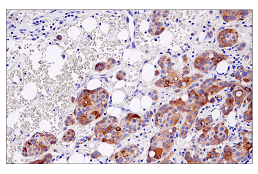 Immunohistochemistry Image 1: Cleaved Gasdermin D (Asp275) (E7H9G) Rabbit mAb (BSA and Azide Free)