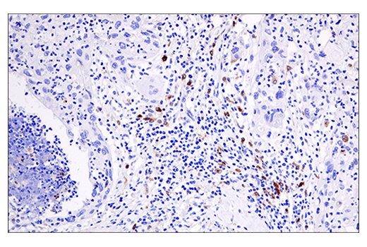 Immunohistochemistry Image 3: Cleaved Gasdermin D (Asp275) (E7H9G) Rabbit mAb (BSA and Azide Free)