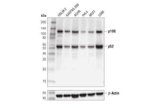  Image 10: NF-κB Family Antibody Sampler Kit II