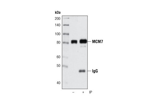 Immunoprecipitation Image 1: MCM7 (D10A11) XP® Rabbit mAb