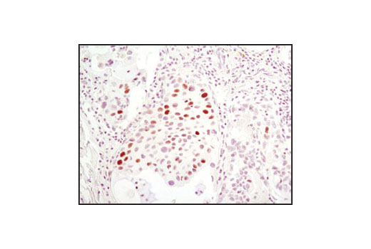 Immunohistochemistry Image 1: MCM7 (D10A11) XP® Rabbit mAb