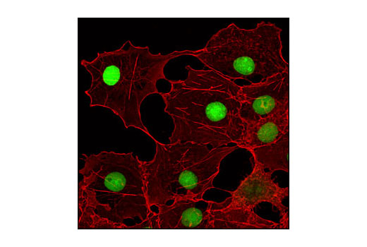 Immunofluorescence Image 1: MCM7 (D10A11) XP® Rabbit mAb