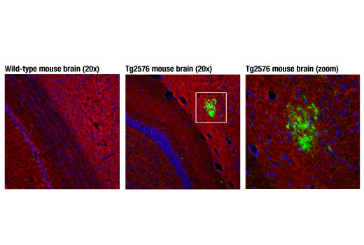 Immunofluorescence Image 1: β-Amyloid (D3D2N) Mouse mAb (BSA and Azide Free)