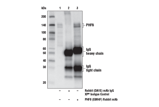 Immunoprecipitation Image 1: PHF8 (E9R4F) Rabbit mAb