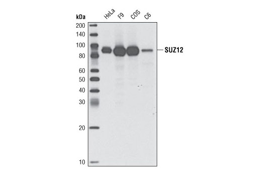  Image 5: Polycomb Group 2 (PRC2) Antibody Sampler Kit