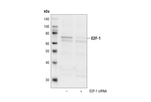 Western Blotting Image 2: E2F-1 Antibody
