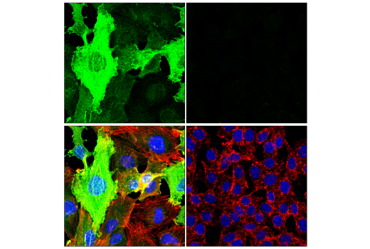 Immunofluorescence Image 1: ZNF185 (E6W4I) Rabbit mAb