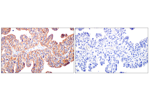 Immunohistochemistry Image 8: ZNF185 (E6W4I) Rabbit mAb