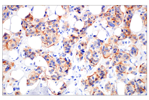 Immunohistochemistry Image 1: ZNF185 (E6W4I) Rabbit mAb