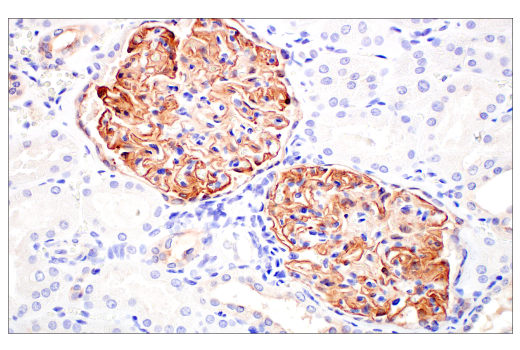 Immunohistochemistry Image 6: ZNF185 (E6W4I) Rabbit mAb
