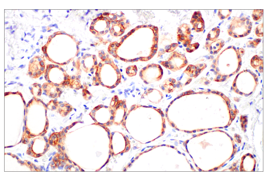 Immunohistochemistry Image 4: ZNF185 (E6W4I) Rabbit mAb