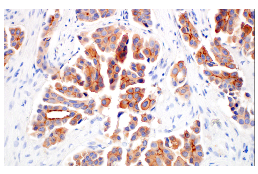 Immunohistochemistry Image 3: ZNF185 (E6W4I) Rabbit mAb