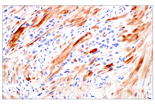 Immunohistochemistry Image 2: ZNF185 (E6W4I) Rabbit mAb