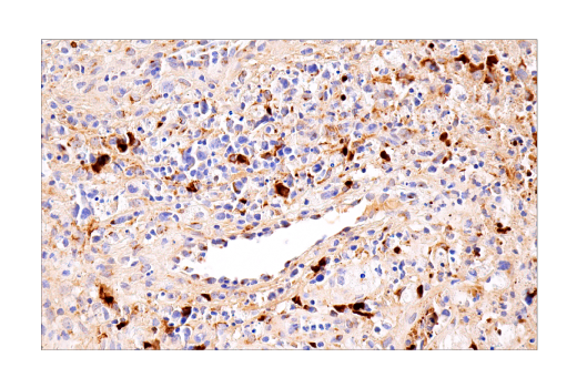 Immunohistochemistry Image 7: CXCL9/MIG (E6Z5W) Rabbit mAb (BSA and Azide Free)