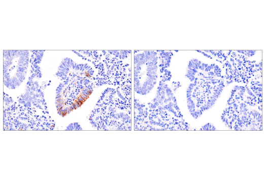 Immunohistochemistry Image 3: CXCL9/MIG (E6Z5W) Rabbit mAb (BSA and Azide Free)