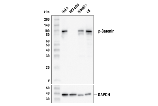 Western Blotting Image 1: β-Catenin (15B8) Mouse mAb