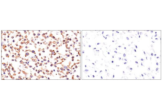 Immunohistochemistry Image 1: β-Catenin (15B8) Mouse mAb