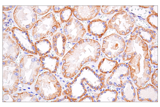 Immunohistochemistry Image 3: β-Catenin (15B8) Mouse mAb
