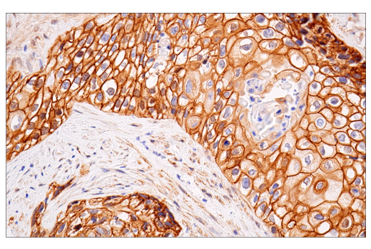 Immunohistochemistry Image 4: β-Catenin (15B8) Mouse mAb