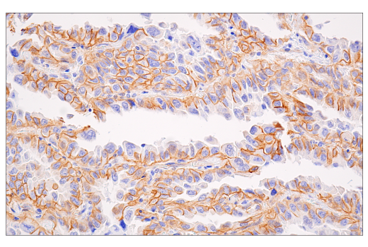 Immunohistochemistry Image 5: β-Catenin (15B8) Mouse mAb