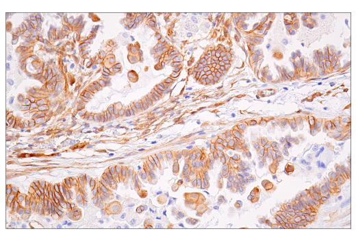 Immunohistochemistry Image 7: β-Catenin (15B8) Mouse mAb
