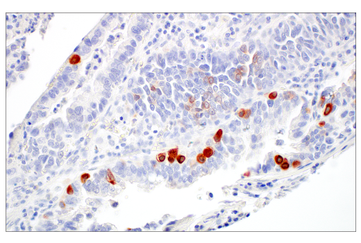 Immunohistochemistry Image 4: GUCY2C (E6I2U) Rabbit mAb