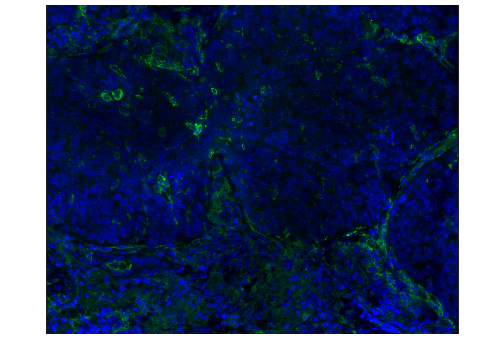 Immunohistochemistry Image 1: CD14 (D7A2T) Rabbit mAb (Alexa Fluor® 488 Conjugate)