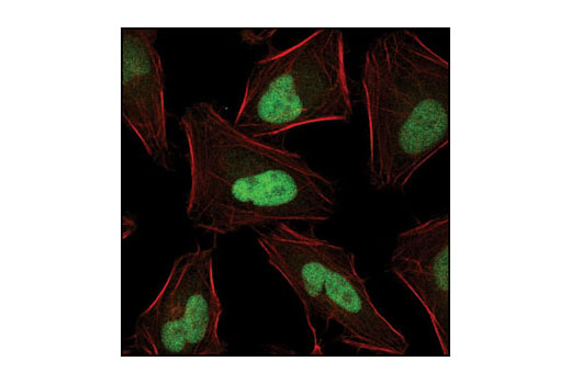 JunB (P169) Antibody | Cell Signaling Technology