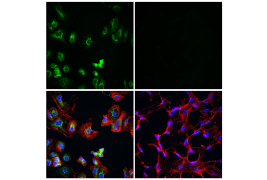 Immunofluorescence Image 3: p22phox (E7Y1F) XP® Rabbit mAb