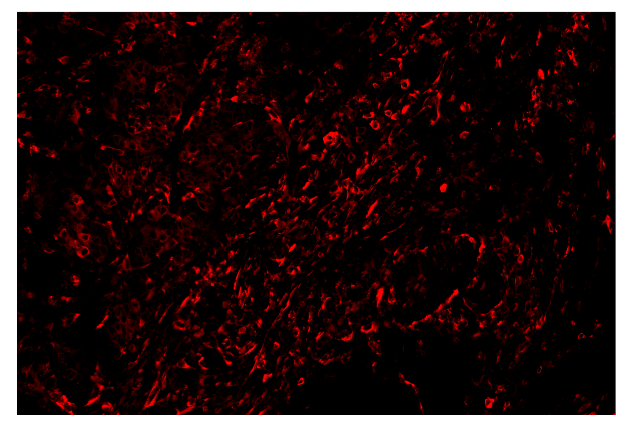 Immunohistochemistry Image 3: Phospho-S6 Ribosomal Protein (Ser235/236) (D57.2.2E) & CO-0107-647 SignalStar™ Oligo-Antibody Pair
