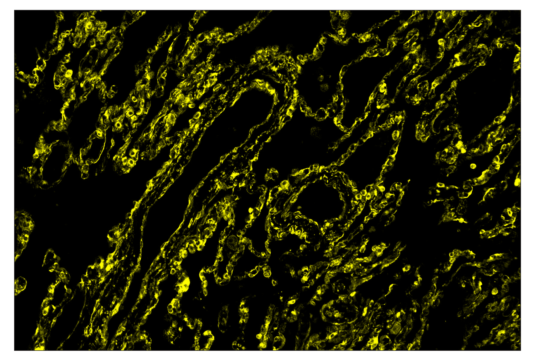 Immunohistochemistry Image 2: Phospho-S6 Ribosomal Protein (Ser235/236) (D57.2.2E) & CO-0107-647 SignalStar™ Oligo-Antibody Pair